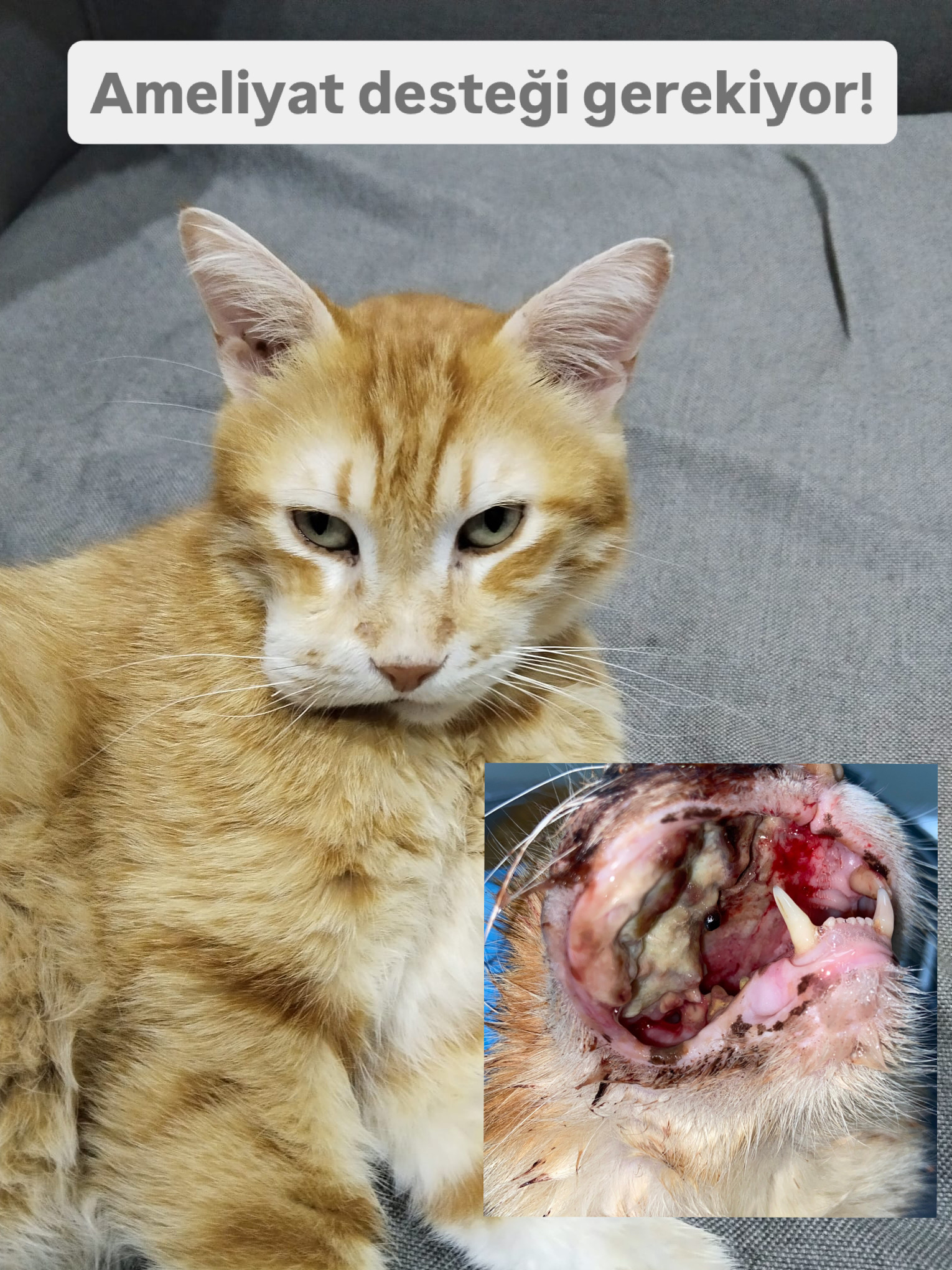 Ameliyat Ücreti Toplanması